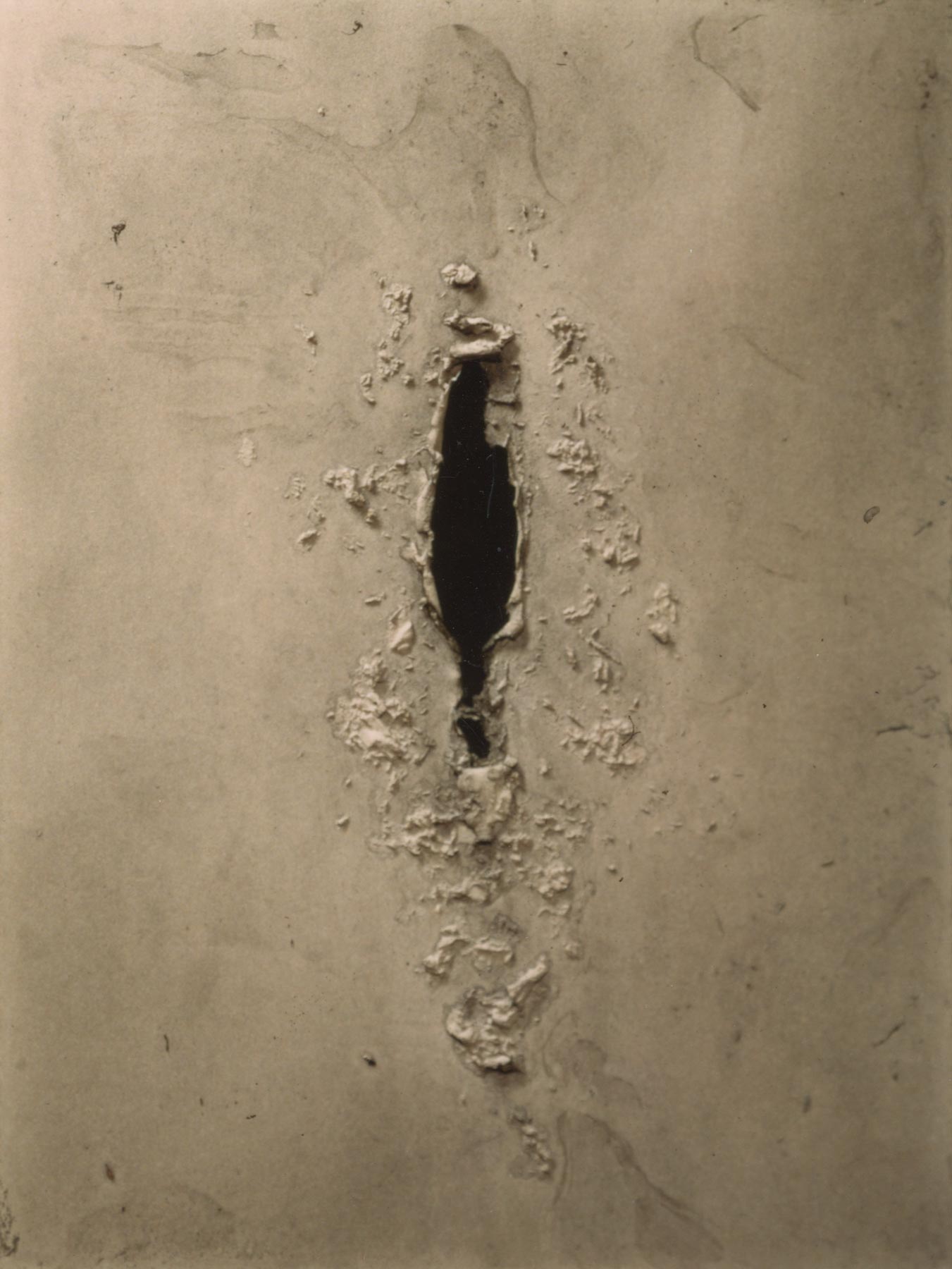 Aus der Serie Verletzungen